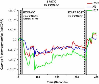 Cerebral Perfusion Monitoring Using Near-Infrared Spectroscopy During Head-Up Tilt Table Test in Patients With Orthostatic Intolerance
